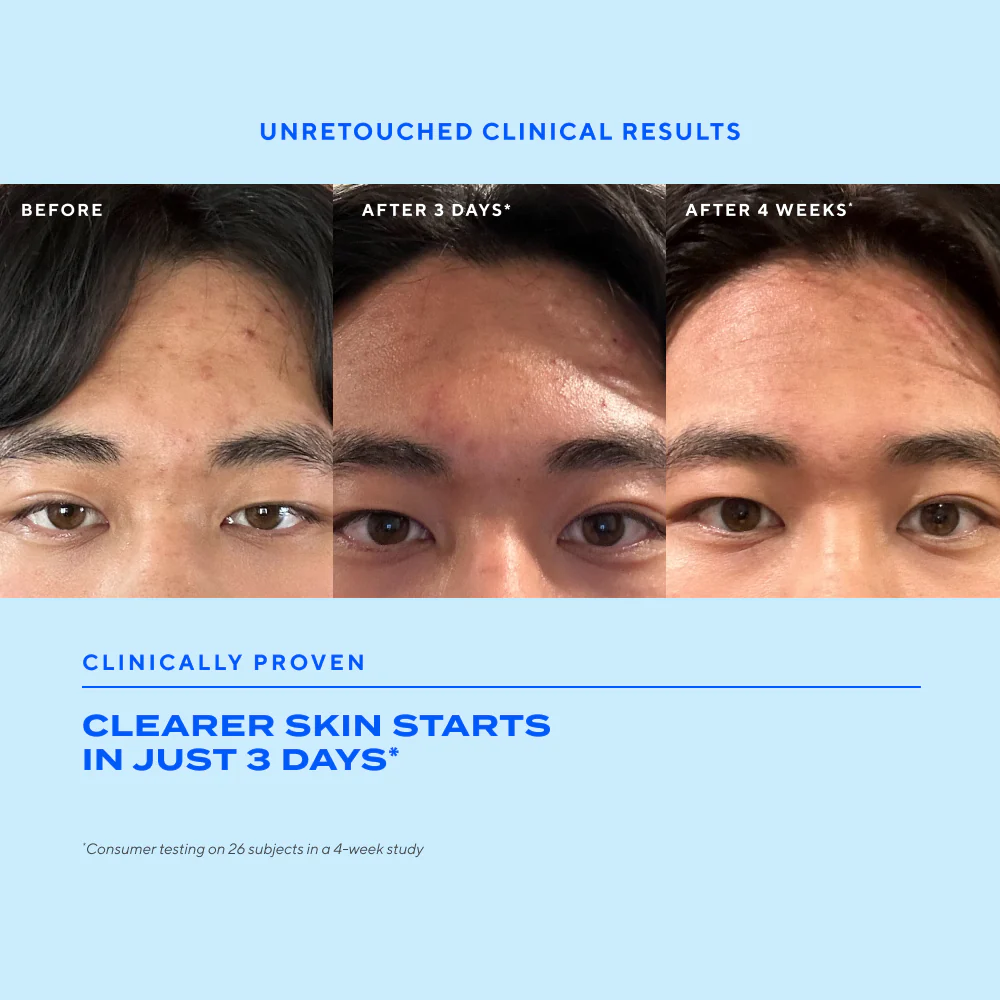 Biome-Balancing Clear & Prevent Blemish Treatment Serum - Image 3