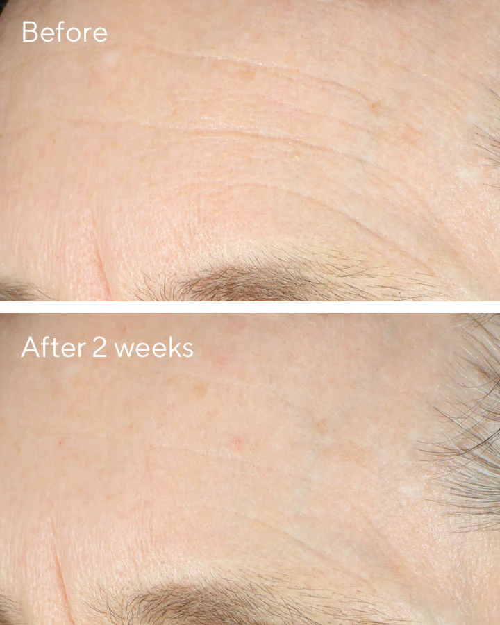 Intense Recovery Cream - Image 4