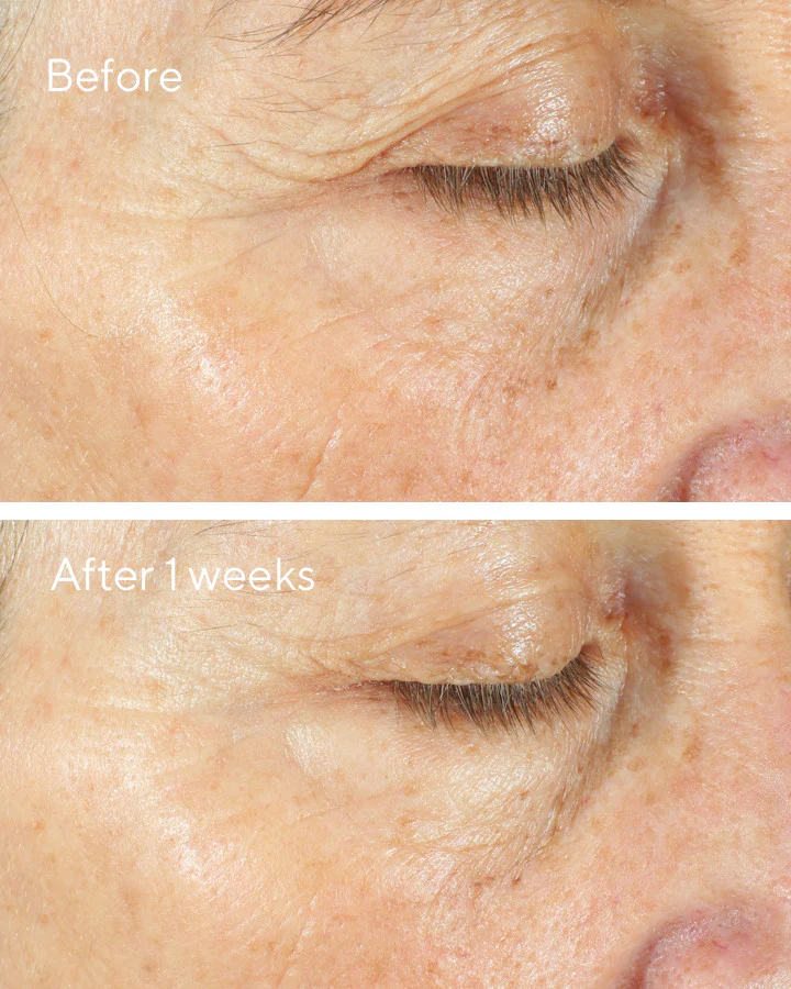 Intense Recovery Cream - Image 5