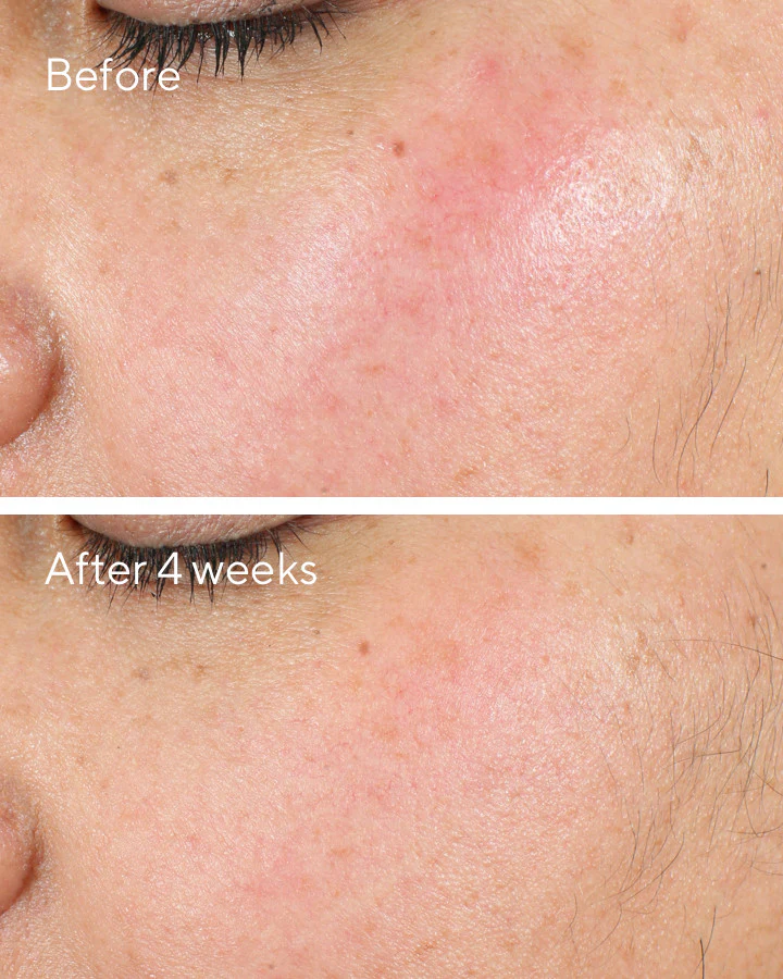 Intense Recovery Cream - Image 6