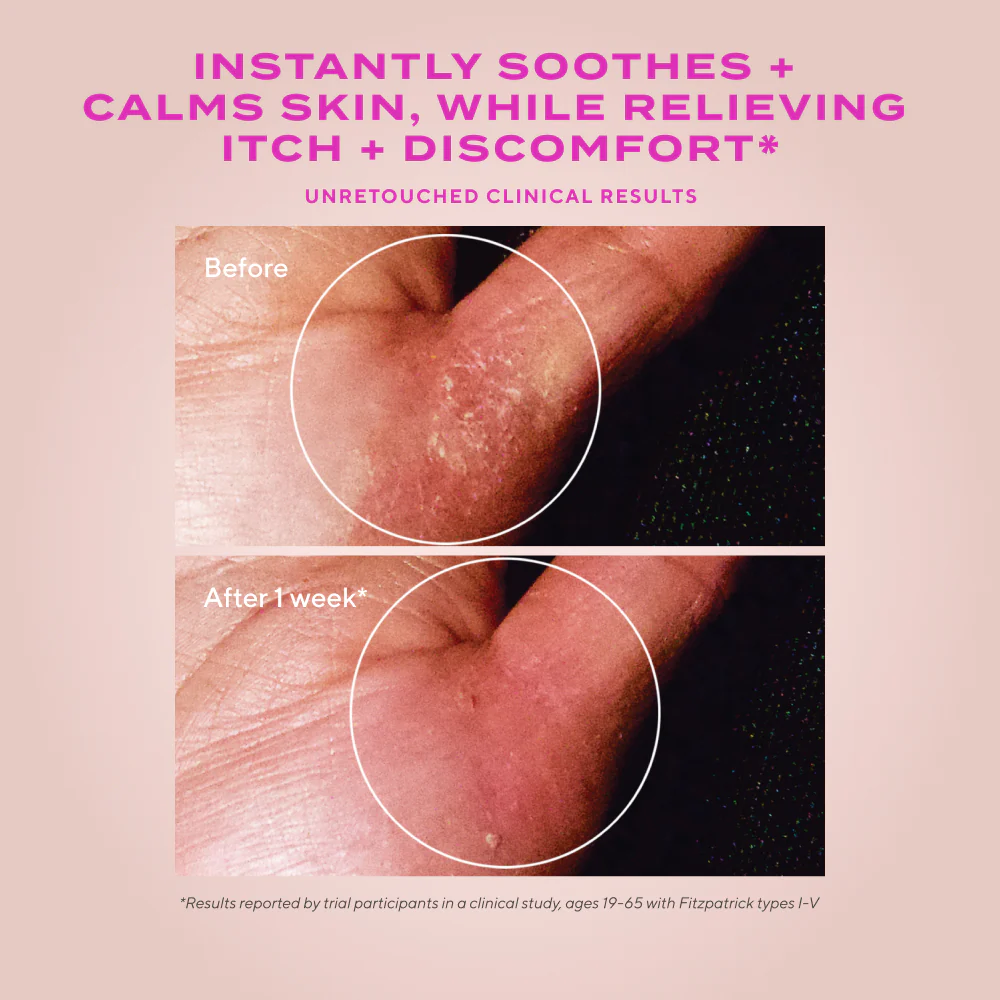 Quick Relief Moisture Treatment - Image 3