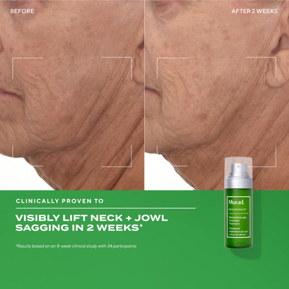 Retinal ReSculpt™ Overnight Treatment - Image 4