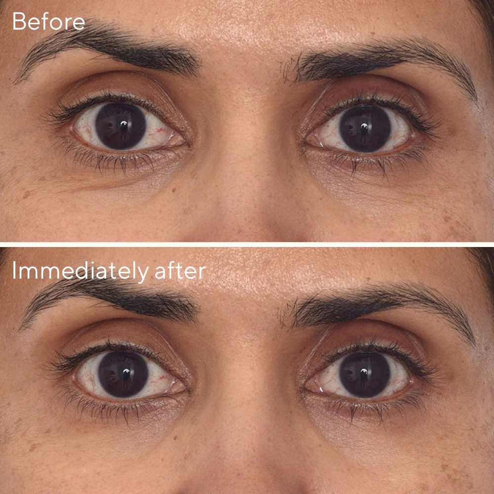 Retinol Youth Renewal  Eye Mask - Single Pack - Image 5