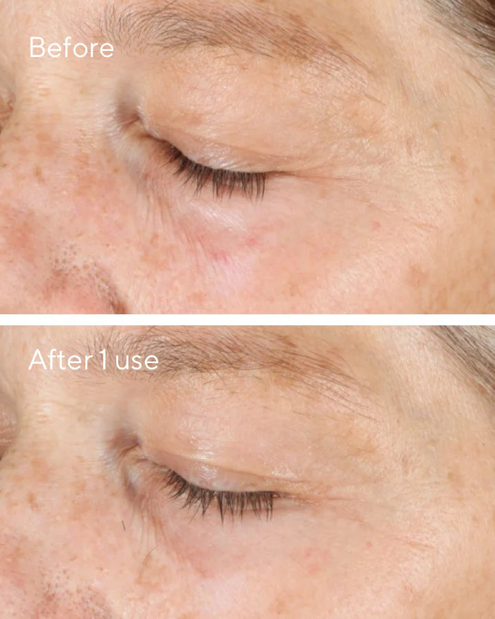 Vita-C Triple Exfoliating Facial - Image 6
